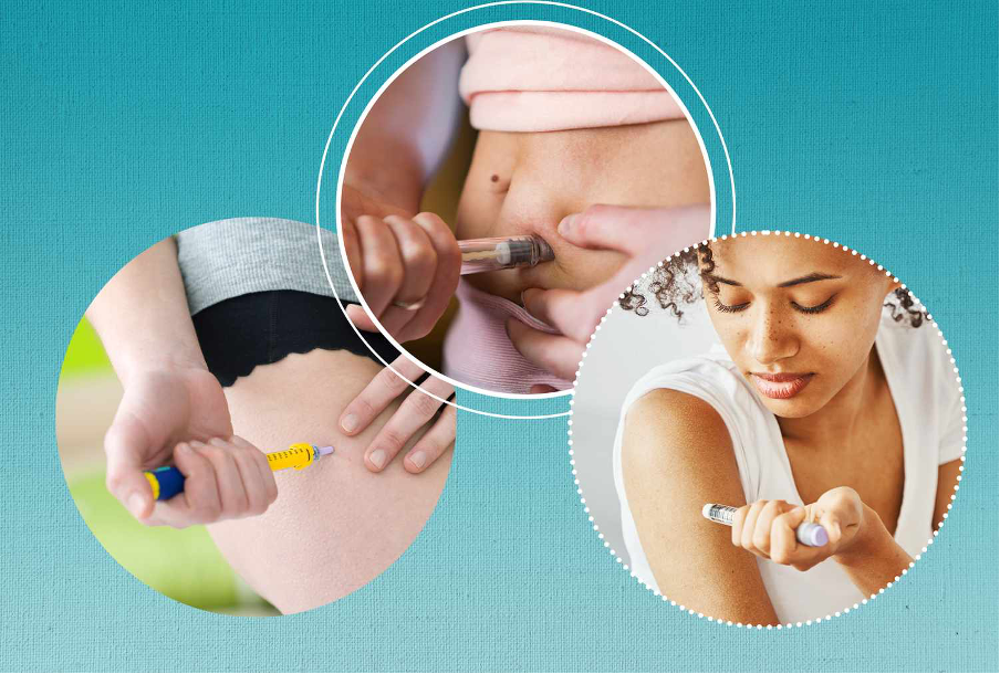 Mounjaro or Ozempic can be injected into the abdomen, thigh or arm